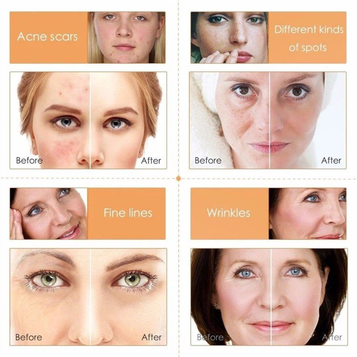 rejuvenating set with serum